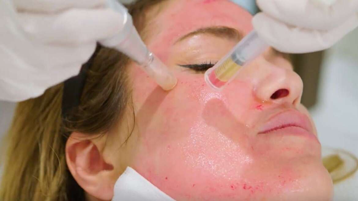 PMU & Micropigmentation