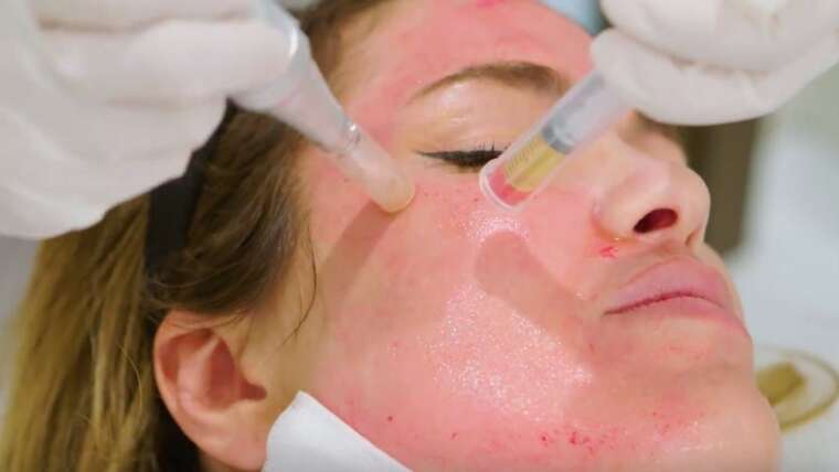 PMU & Micropigmentation