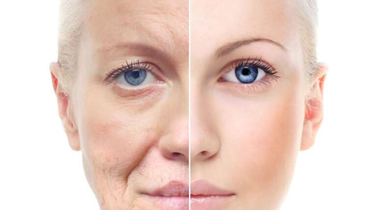 Skin Tightening Treatment