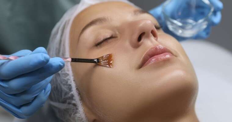 Chemical Peel Treatments at Reorma: The Safe Path to Smoother, Brighter Skin