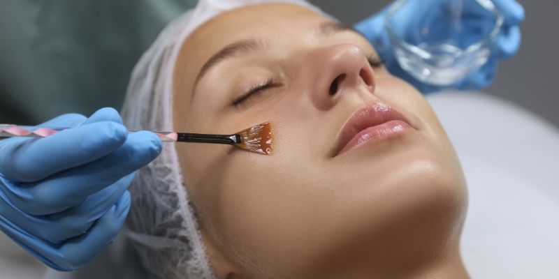 Chemical Peel Treatments at Reorma: The Safe Path to Smoother, Brighter Skin